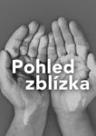 Pohled zblízka